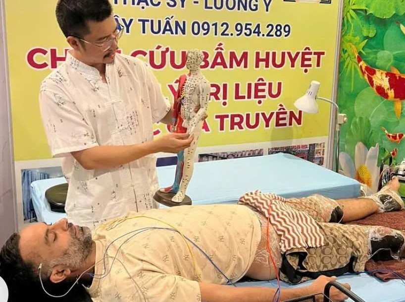 Châm cứu êm gia truyền (Thiền Châm)