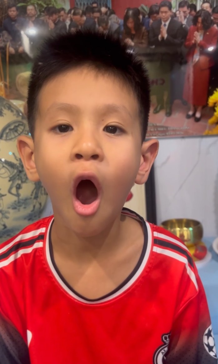 KỲ TÍCH 4 NGÀY: BÉ LỚP 3 HẾT MÉO MIỆNG, LIỆT MẶT BẰNG PHÁC ĐỒ KHÔNG CHÂM CỨU!