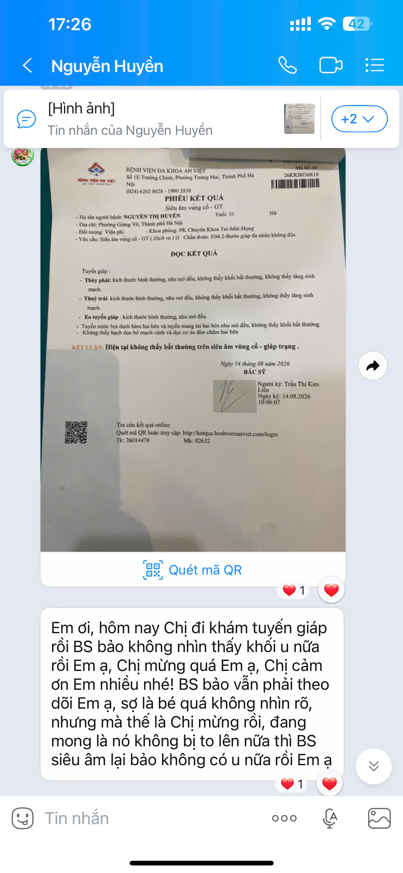 KỲ TÍCH NỐI TIẾP KỲ TÍCH TẠI ĐÔNG Y ATHENA: NHÂN XƠ TUYẾN GIÁP (TIRADS 3) BIẾN MẤT HOÀN TOÀN SAU PHÁC ĐỒ TRỊ LIỆU!