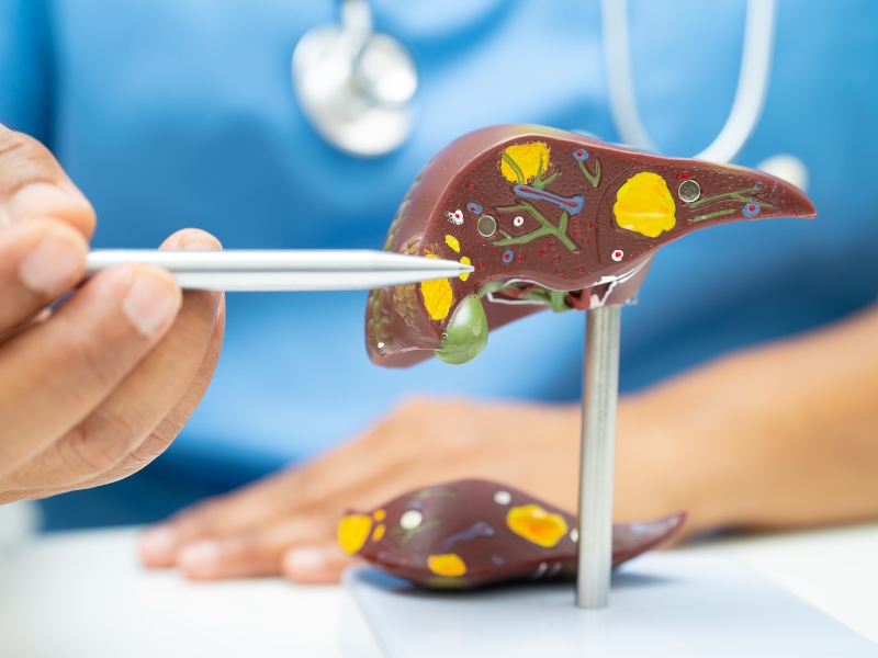 Can Đởm Nhiệt: Nguyên nhân, triệu chứng, chẩn đoán, điều trị