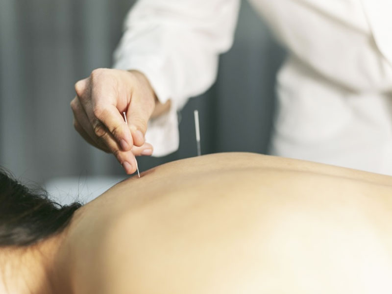 Châm Cứu Điều Trị Đau Khớp Vai Lưng