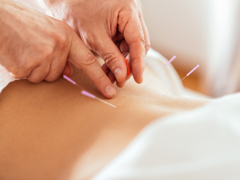 Tác dụng của việc châm cứu đối với sức khỏe người bệnh